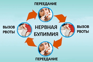 Лечение булимии в городе Буй